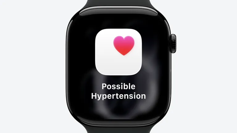 Apple Watch Series 11