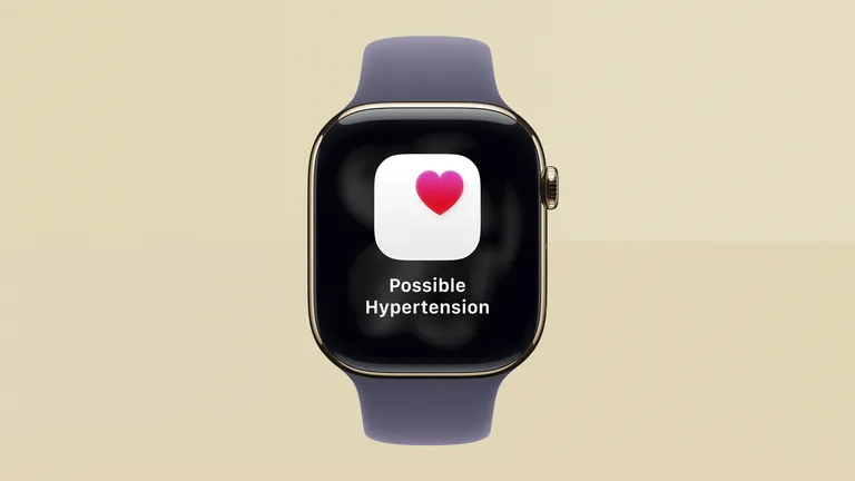 watchOS 26